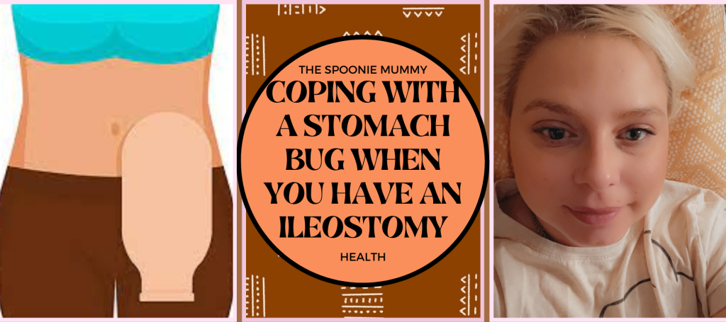 Coping With A Stomach Bug When You Have An Ileostomy