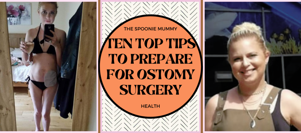 Ten Top Tips To Prepare For Ostomy Surgery