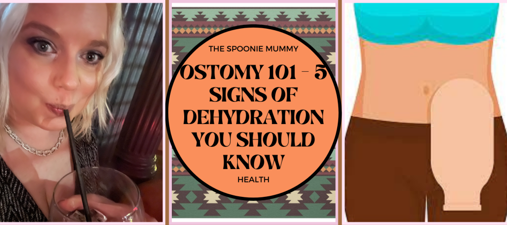 Ostomy 101 – 5 Signs of Dehydration You Should Know